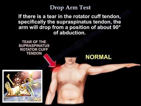 rotator cuff arm drop test|rotator cuff tear physical exam.